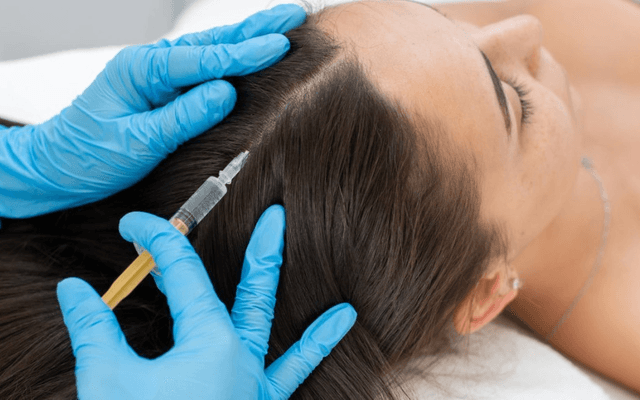 Best PRP Hair Treatment: Real Results