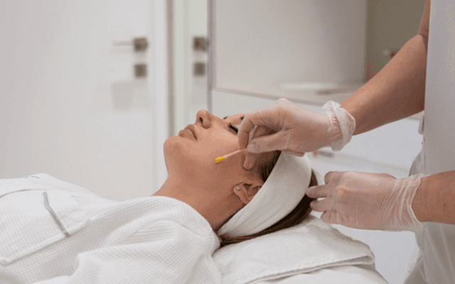 What is the cost of a professional chemical peel?