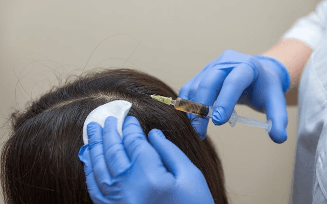 Can Women Try Hair Plasma Treatment? 