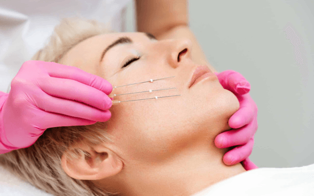 Thread Lift vs Facelift: Which Option Works Best Now