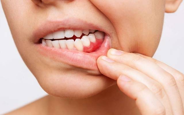 How Gum Disease Treatment London Helps: Dentist Near Me
