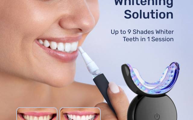 Wella White Teeth Whitening Kit vs. Dentist: Which is Better? (Reviews Inside)