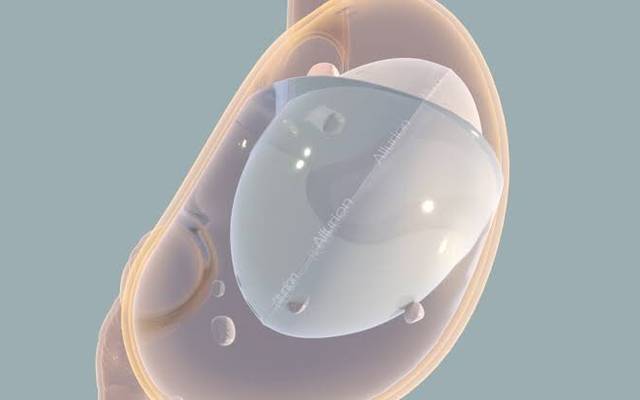 5 Ways Our Clinic Stands Out for Allurion Gastric Balloon Treatment