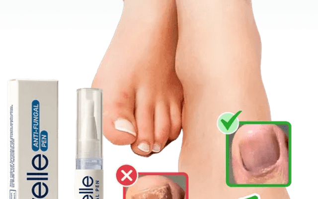 Orivelle Anti Fungal Pen Erfahrungen Lohnt sich der Kauf?