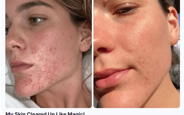 Clarexin Intestinal Detox Capsules – Powerful Parasite Cleanse for Men & Women