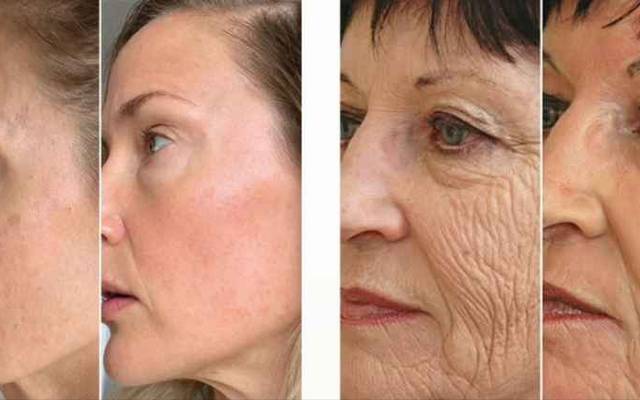 GloraMD Face Lift Serum: The Ultimate Secret to Ageless, Radiant Skin?