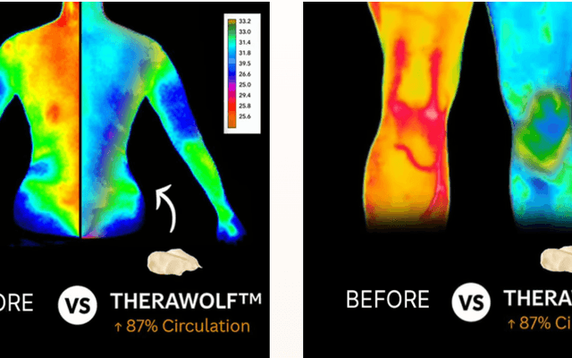 TheraWolf Neuro Balm in Ethiopia
