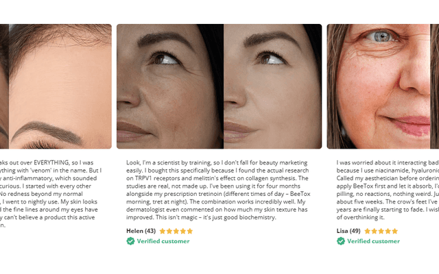 BeeTox Anti-Aging UK: Why Every Woman Over 40 in London is Talking About This