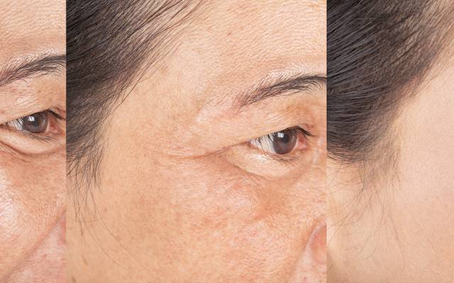 BeeTox Anti-Aging Switzerland: Meine Haut sah müde und fahl aus, bis ich dieses Geheimnis entdeckte.