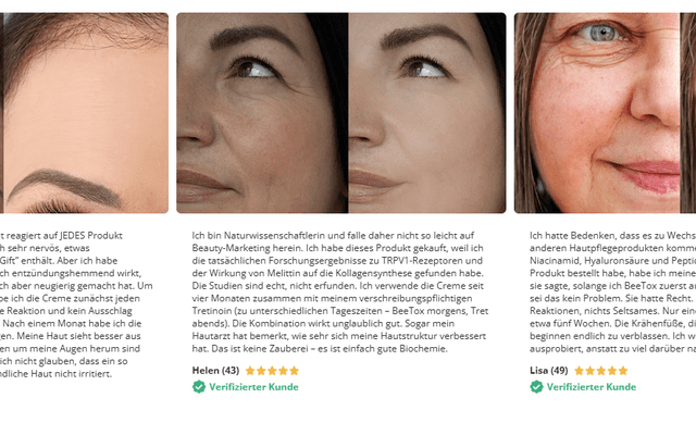 BeeTox Anti-Aging Germany: Ich hatte Angst vor Bienengift, aber meine Haut sah noch nie besser aus.