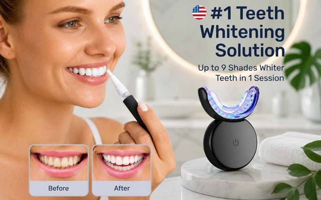Wella White Teeth Whitening Kit vs. Dentist: Which is Better? (Reviews Inside)