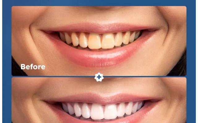 Introduction to BriteWite Teeth Whitening Powder Australia