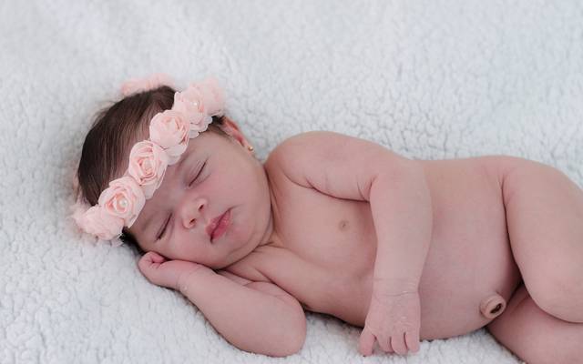 Hérnia Umbilical em Bebê