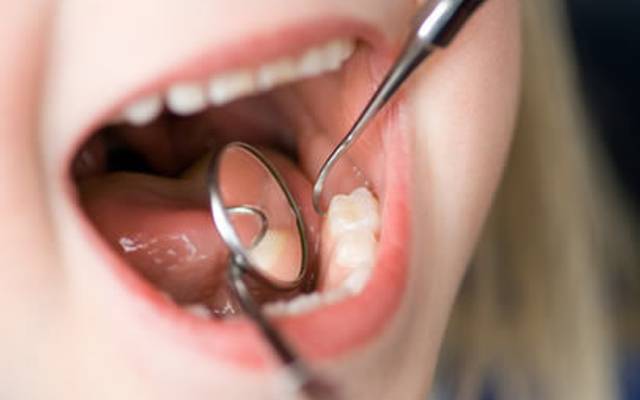 Quais dentes formam a dentição decídua ?