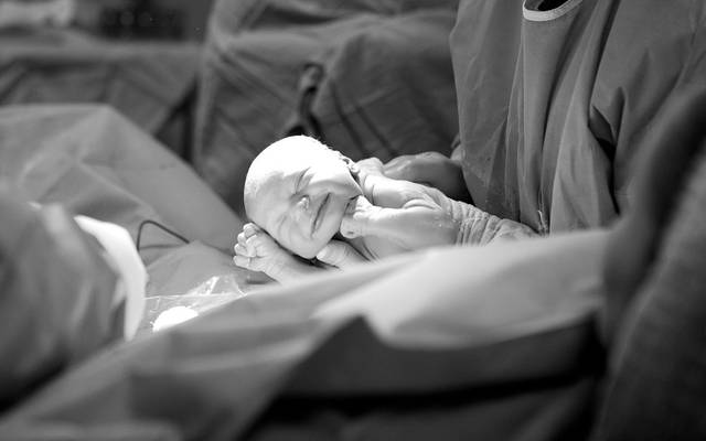 Fotografia de Parto | A chegada da Amanda