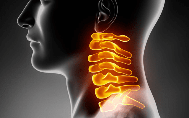 Porque Você Sofre com Dores no Pescoço?