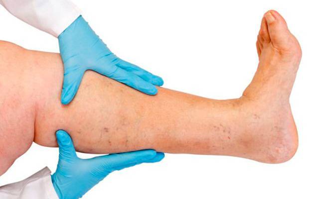 CONHEÇA AS CONTRA INDICAÇÕES DO SPA DOS PÉS PARA QUEM TEM TROMBOSE