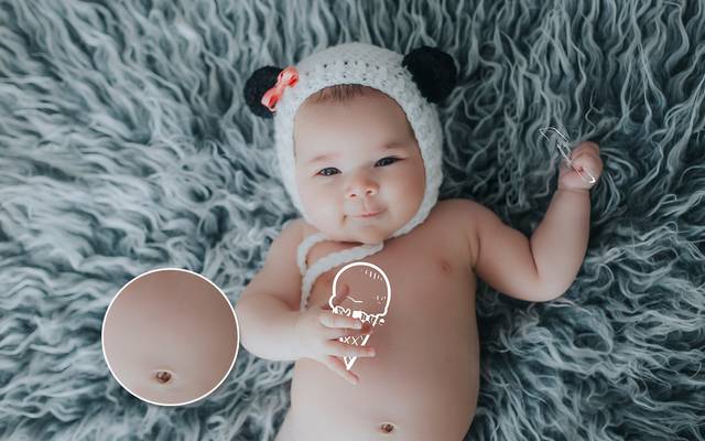 Como cuidar do cordão umbilical do recém-nascido