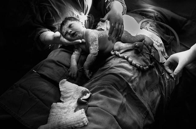 Partos de Parto . Júlia