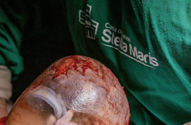 PARTOS de FOTOGRAFIA DE PARTO 