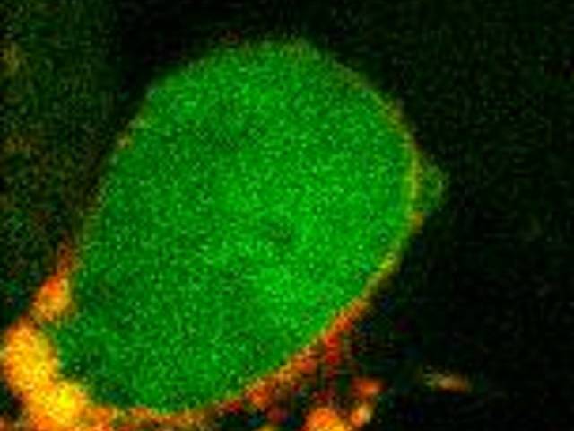 Microscopy by me of Malaria liver stage 