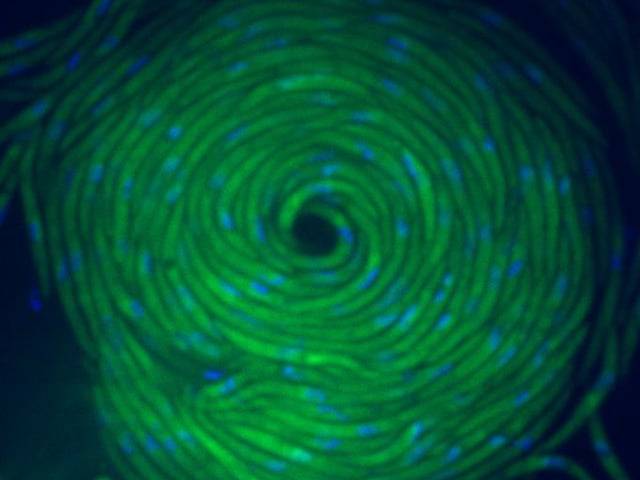 Microscopy © Not Me of Colective Movement- Plasmodium Wirhls