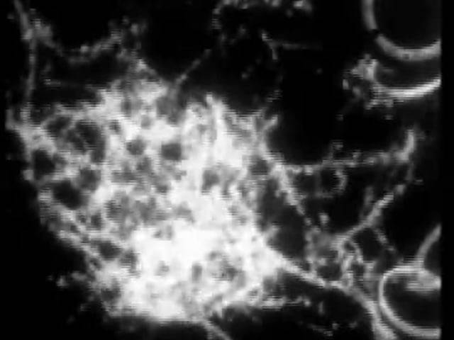 Microscopy © Not Me of Jean Comandon pioneer of microcinematography?