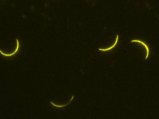 Microscopy by me of Running fast against the clock