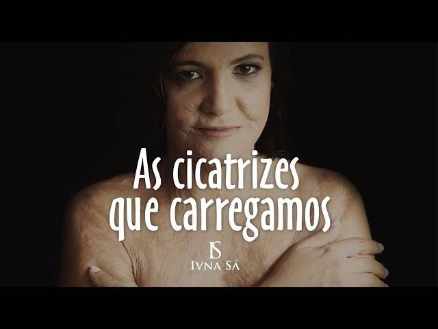 Mulheres de 30 + de VALÉRIA - 34 ANOS 