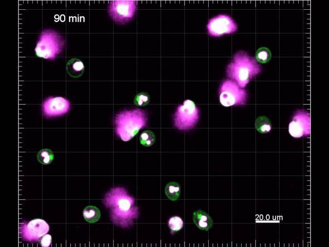Microscopy © Not Me of Neutrophil extracellular traps (NETs)