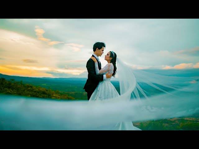 Álbuns Diagramados de Allan e Bruna