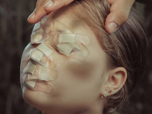 Belas Artes de Belas artes