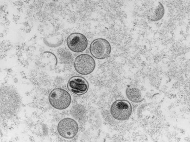 Notícias de Brasil registra primeira morte por varíola dos macacos 