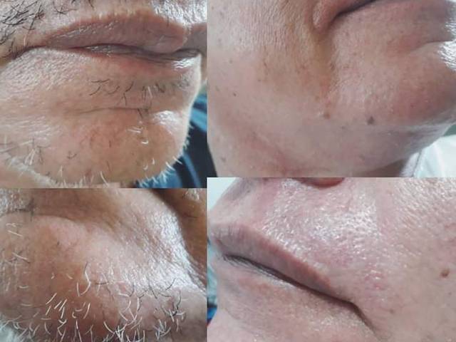 Masculino de Corte e barba