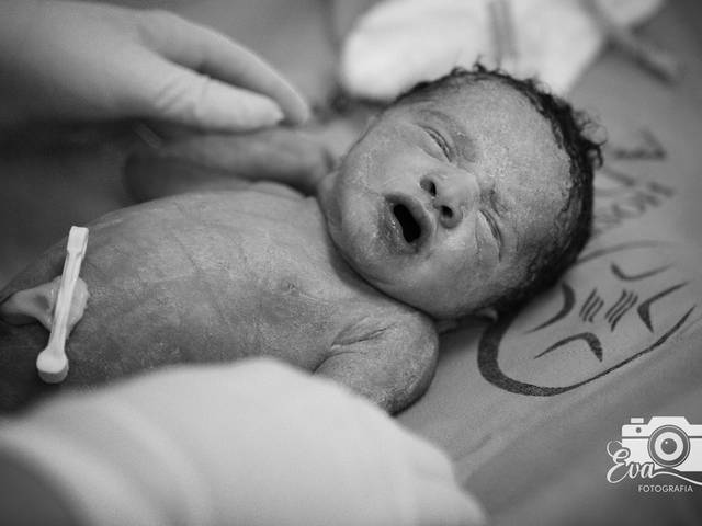 Parto de Nascimento da Mama