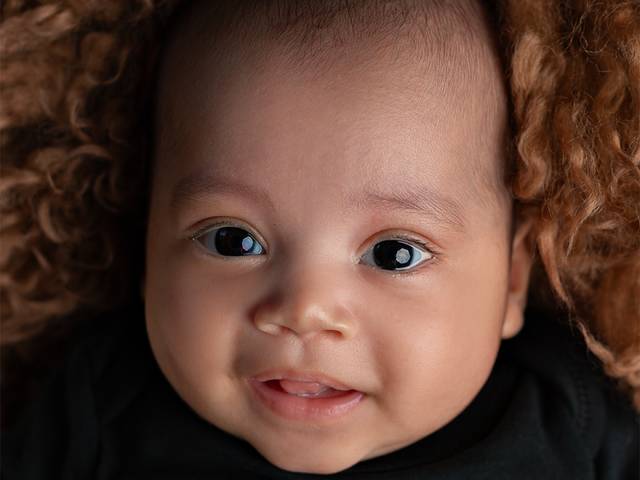 Acompanhamento de 3 meses de Nasttadson