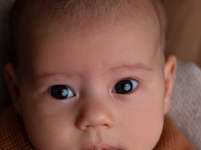 Acompanhamento de 2 meses de Emanuel