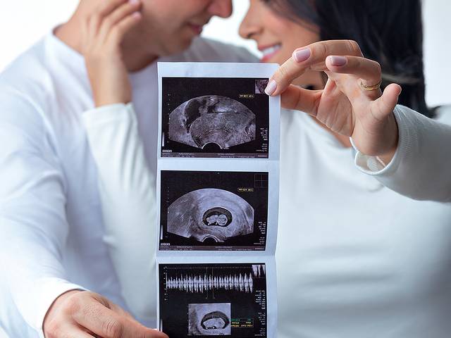 Revelação de Alyne, Thiago e Alice descobrem Valentina