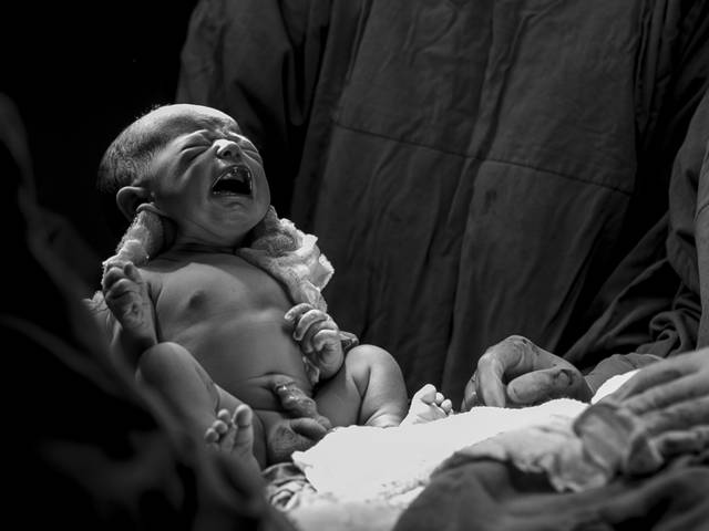 Parto de Nascimento do Henrique 