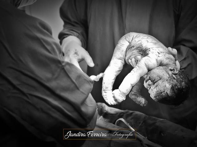 Parto de Parto Helena