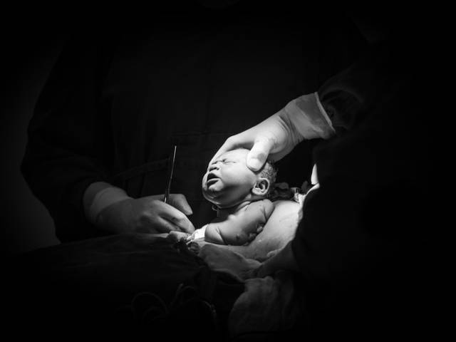 Parto de Nascimento da Paola