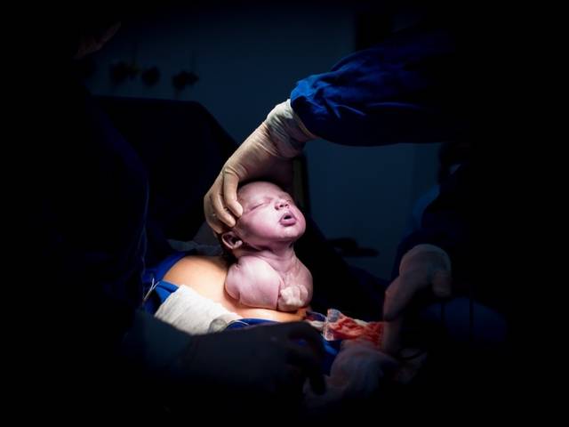 Parto de Nascimento da Olívia