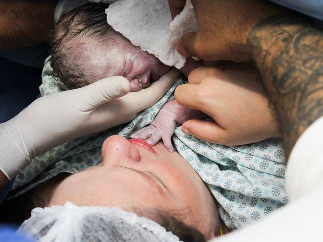 Parto de Parto Lolla 