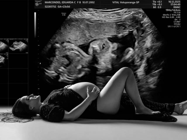 Gestantes de Eduarda e Guilherme - Gestação da Aurora