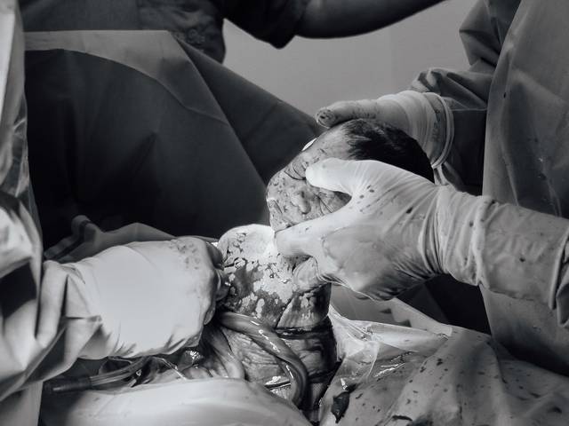 Parto de Fotografia de Parto - Pedro Chegou!