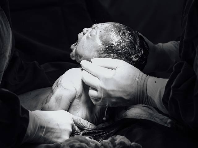 Parto de Fotografia de Parto - Benício Chegou