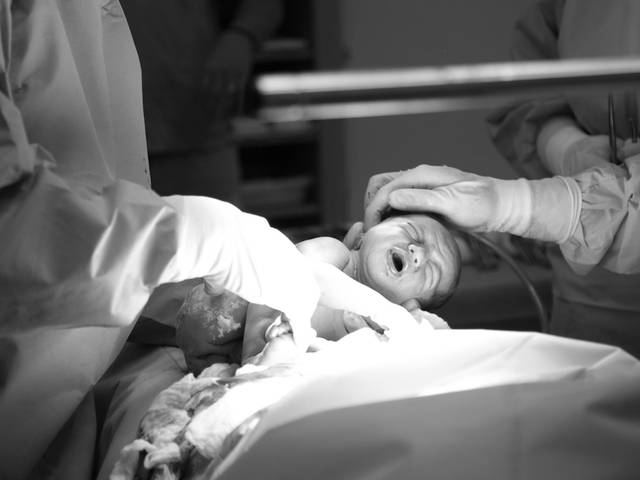 PARTO de Parto Bento