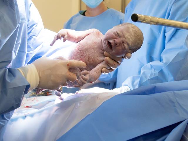 PARTO de Parto Isabela