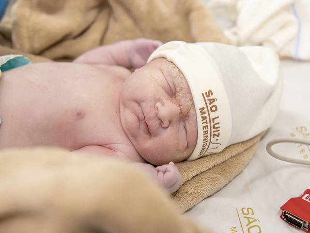 PARTO de PARTO PEDRO