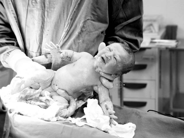 Parto de Nascimento Levi